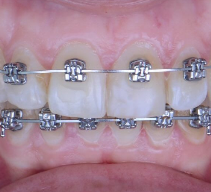 Before Image