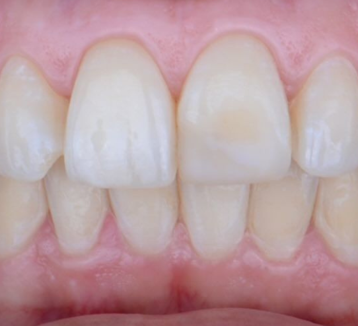 After Image